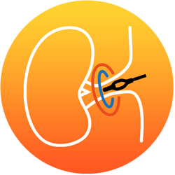 recor-mecical-paradise-ultrasound-rdn-treatment